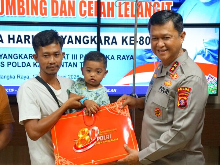 Gelar Bakti Kesehatan Polri, Polda Kalteng Berikan Harapan dan Senyuman Baru bagi Pasien Bibir Sumbing di Hari Bhayangkara ke-80